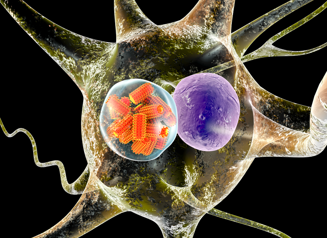 Tollwut-Virus auf Organspende tötet Patienten